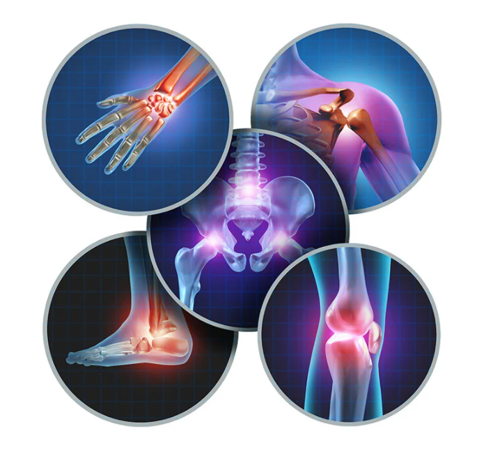 examples of joint pain 
